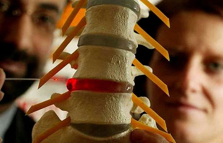 mudanças na integridade dos discos intervertebrais