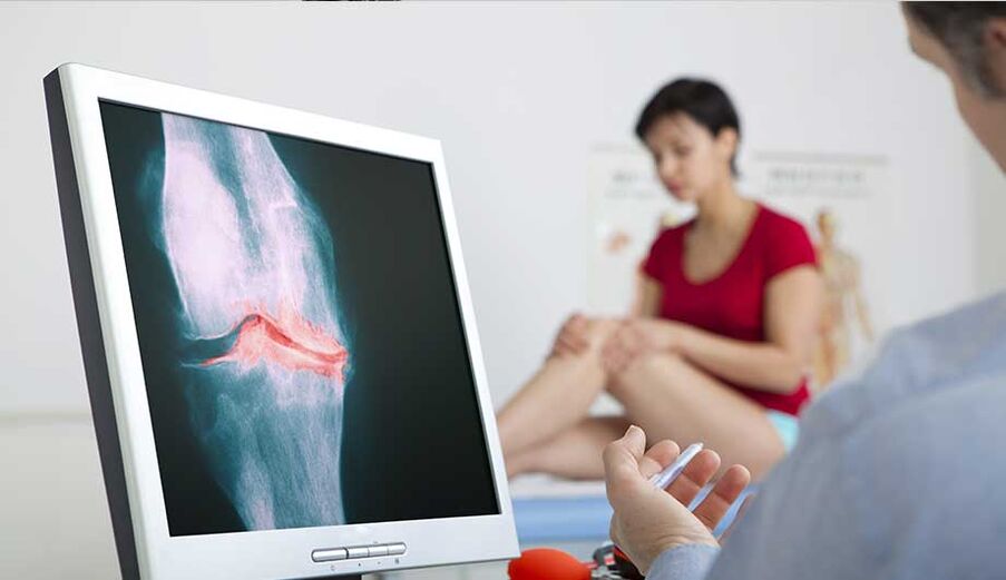 Consulta com um médico se houver suspeita de artrite ou artrose