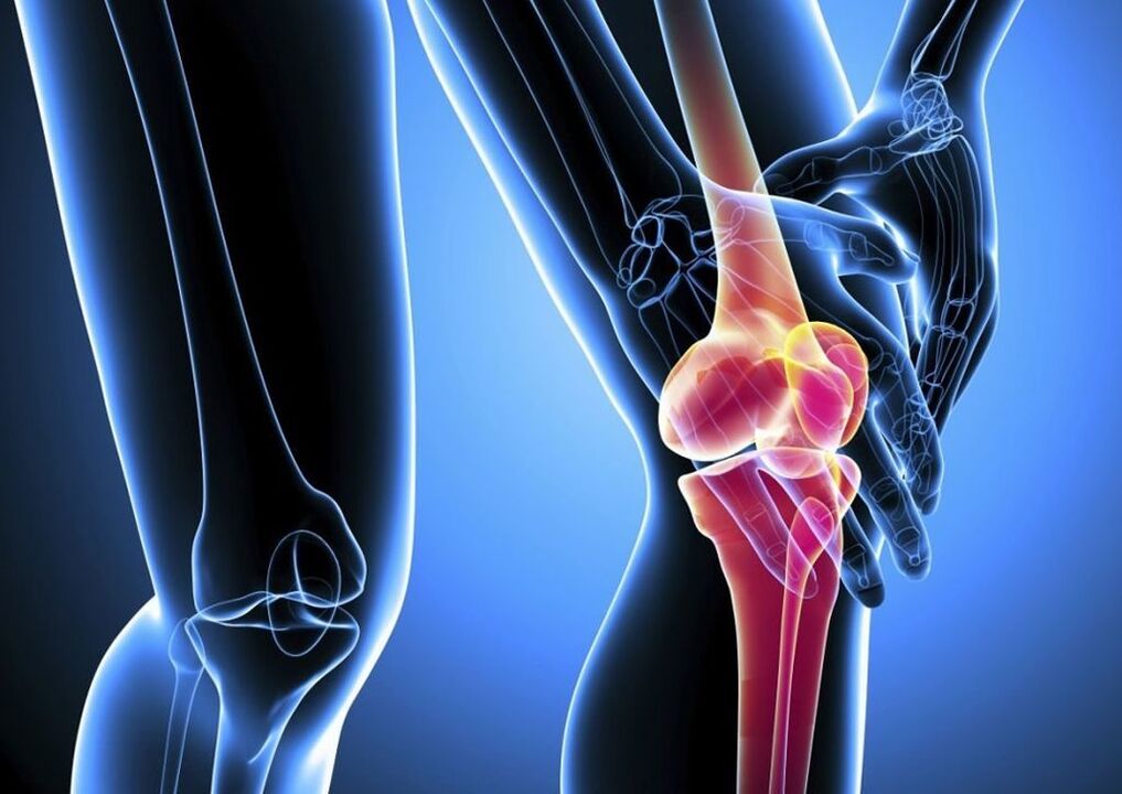 Dor durante a atividade física na osteoartrite da articulação do joelho