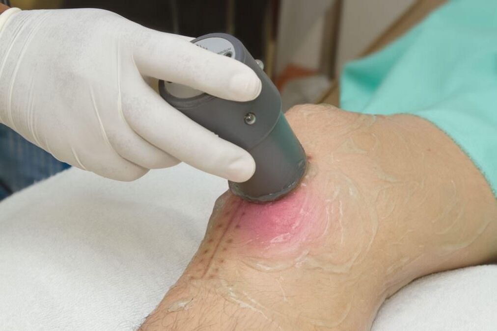 Procedimento de fonoforese para artrite da articulação do joelho