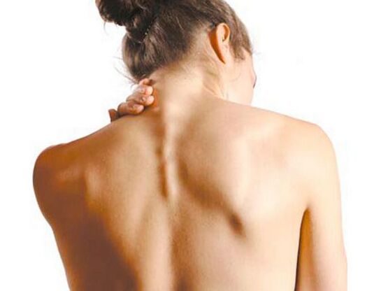 A menina tem osteocondrose cervical