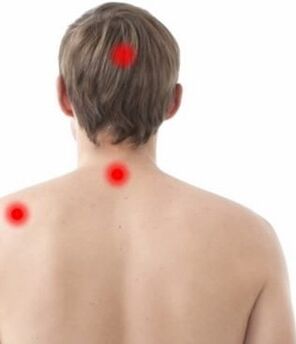 local da dor na osteocondrose cervical