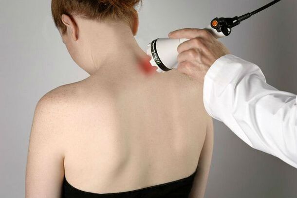 medidas fisioterapêuticas para o tratamento da osteocondrose cervical