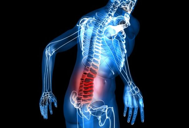 o que é osteocondrose lombar